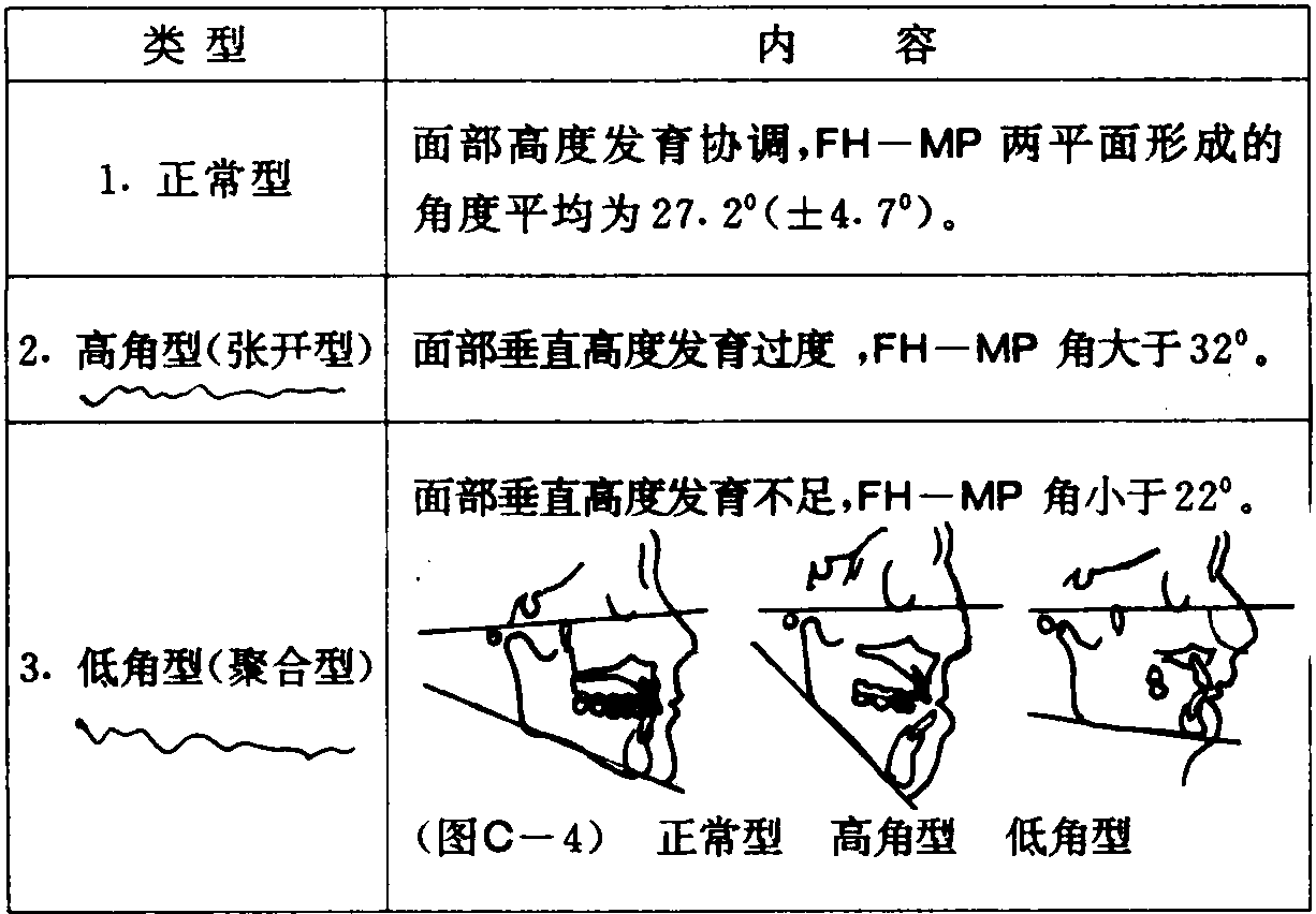 C-7 垂直骨面型分類法